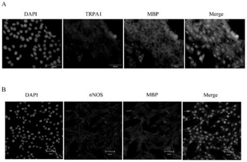 Application of TRPA1 inhibitor in preparation of medicine for treating multiple sclerosis