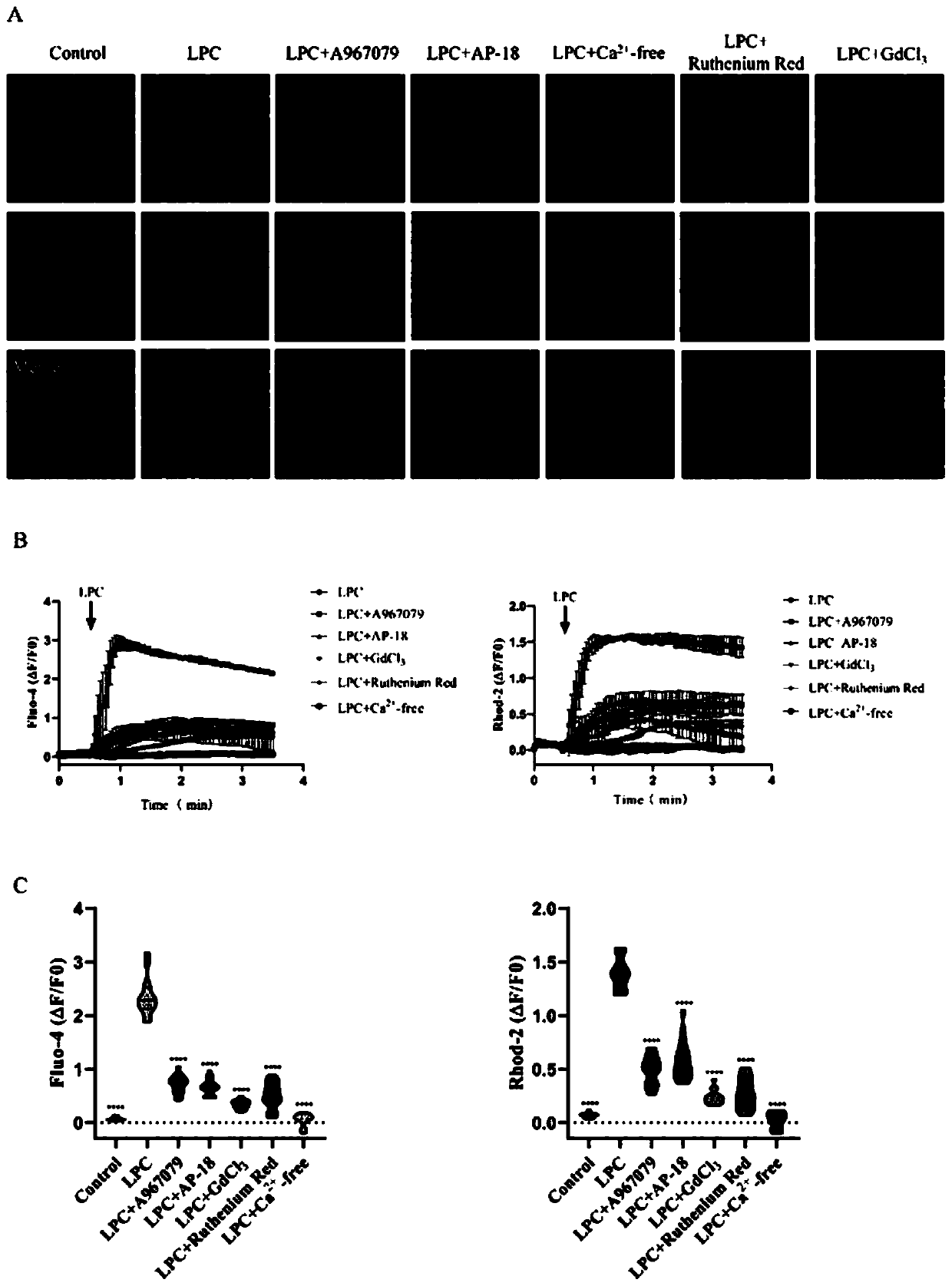 Application of TRPA1 inhibitor in preparation of medicine for treating multiple sclerosis