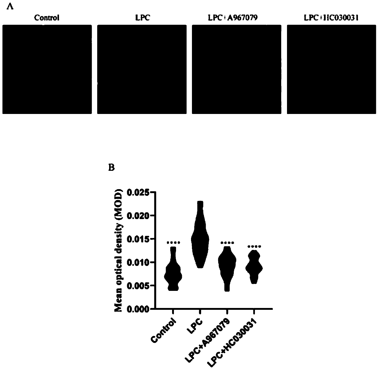 Application of TRPA1 inhibitor in preparation of medicine for treating multiple sclerosis