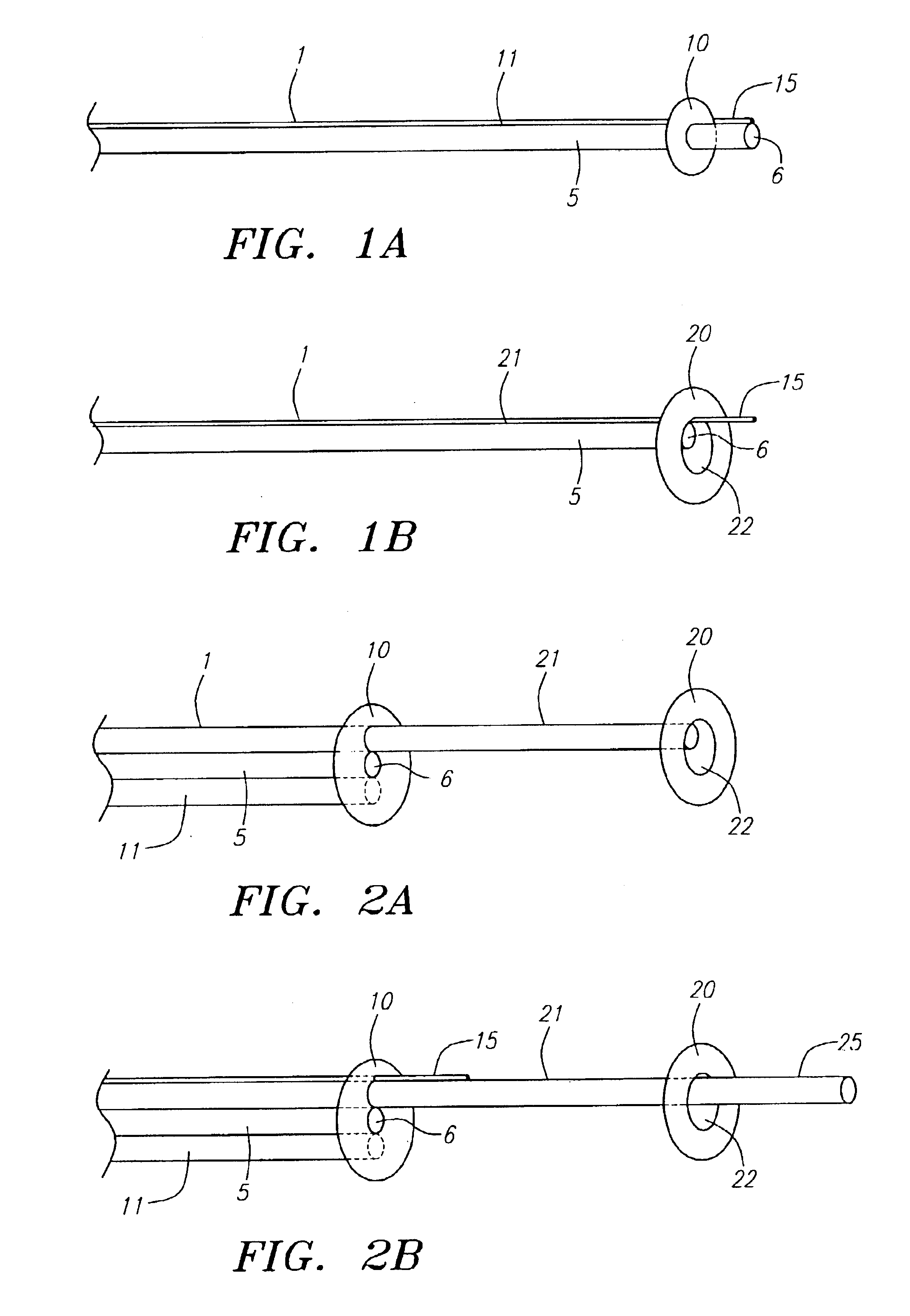 Devices and methods for preventing distal embolization using flow reversal in arteries having collateral blood flow