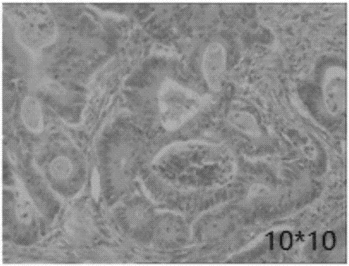 Composition for treating colon cancer as well as preparation method and application of composition