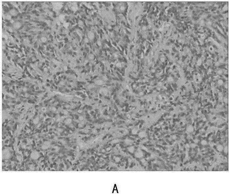 Composition for treating colon cancer as well as preparation method and application of composition