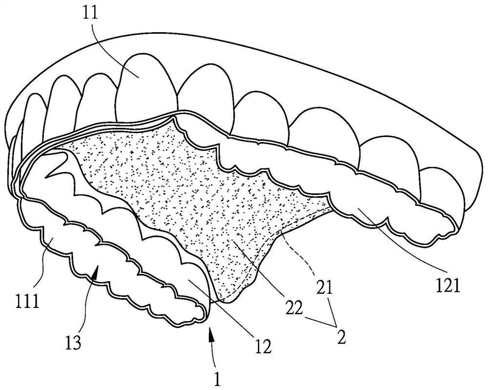 Intraoral swallowing training aid with open occlusal surface and manufacturing method of intraoral swallowing training aid