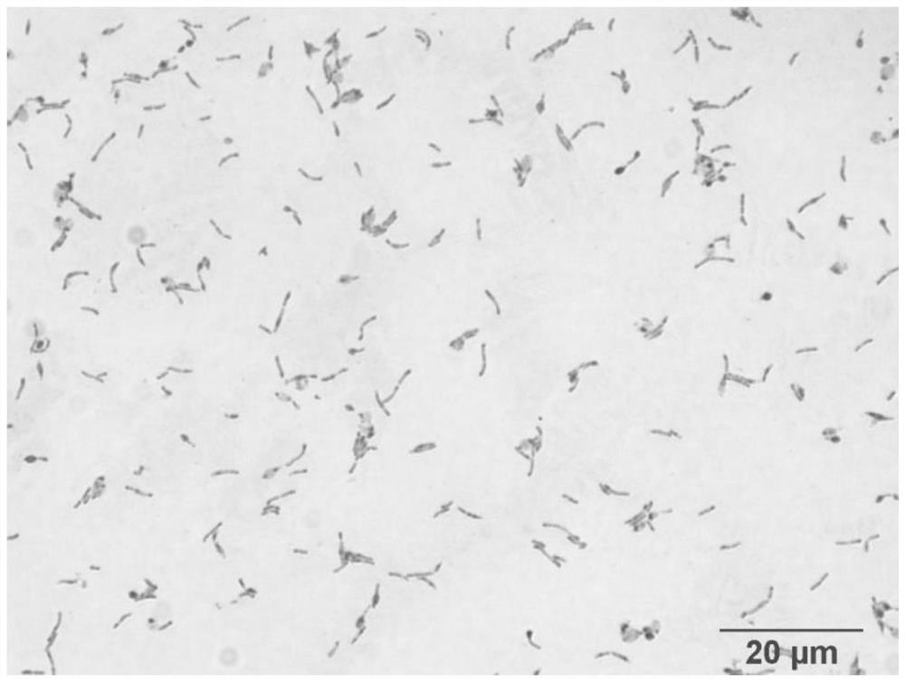 Bifidobacterium longum SYSU-02 and application thereof