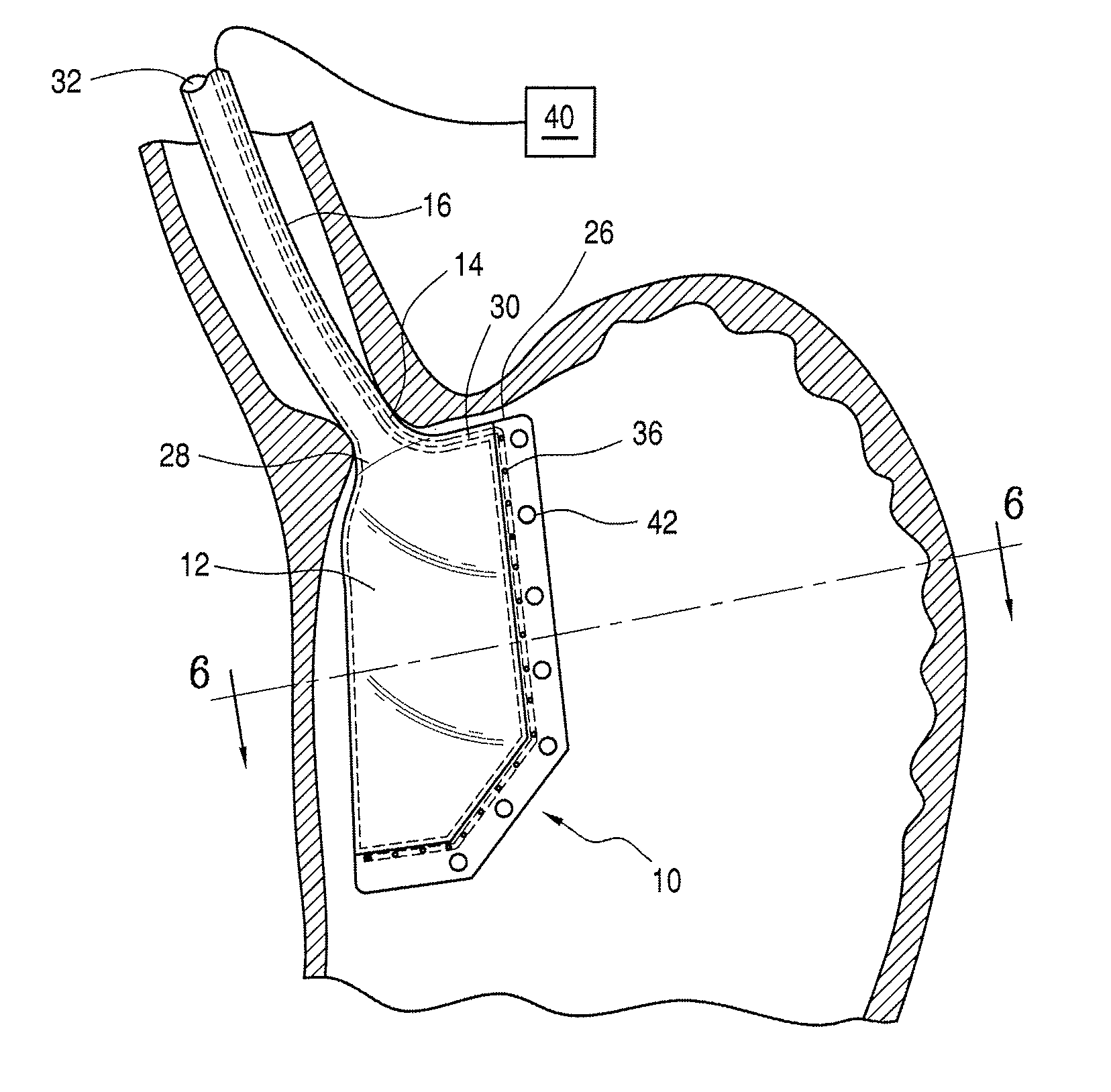Method and apparatus for marking a lumenal wall