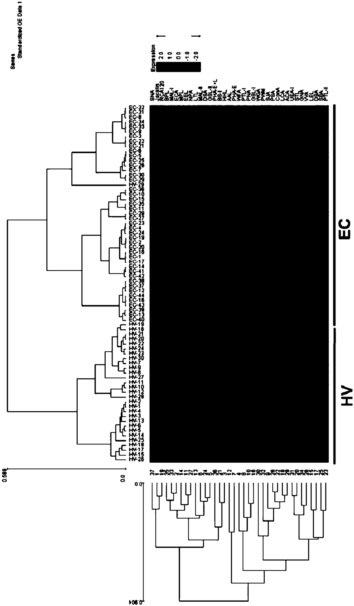 Application of specific lectin combination in identifying esophageal cancer based on saliva sugar types