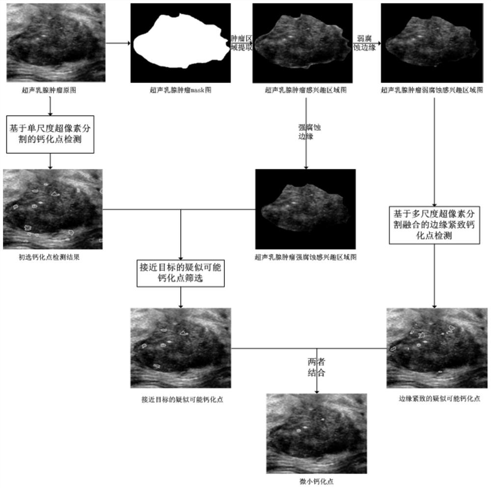 Automatic detection method of tiny calcifications based on ultrasound breast tumor images