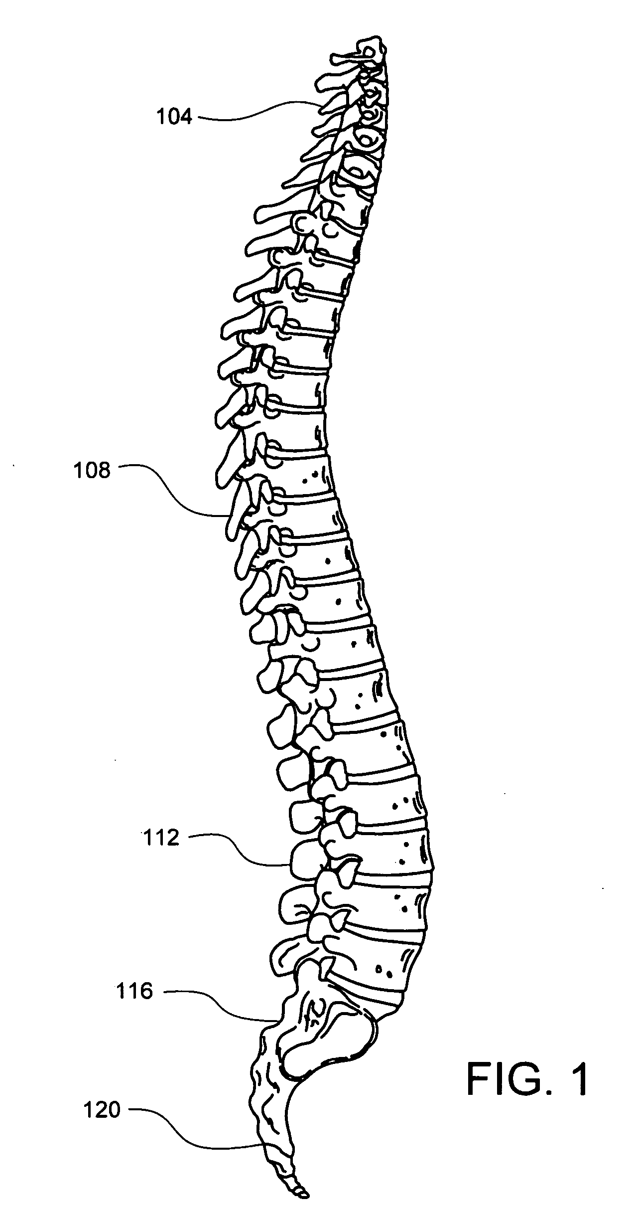 Driver assembly for simultaneous axial delivery of spinal implants