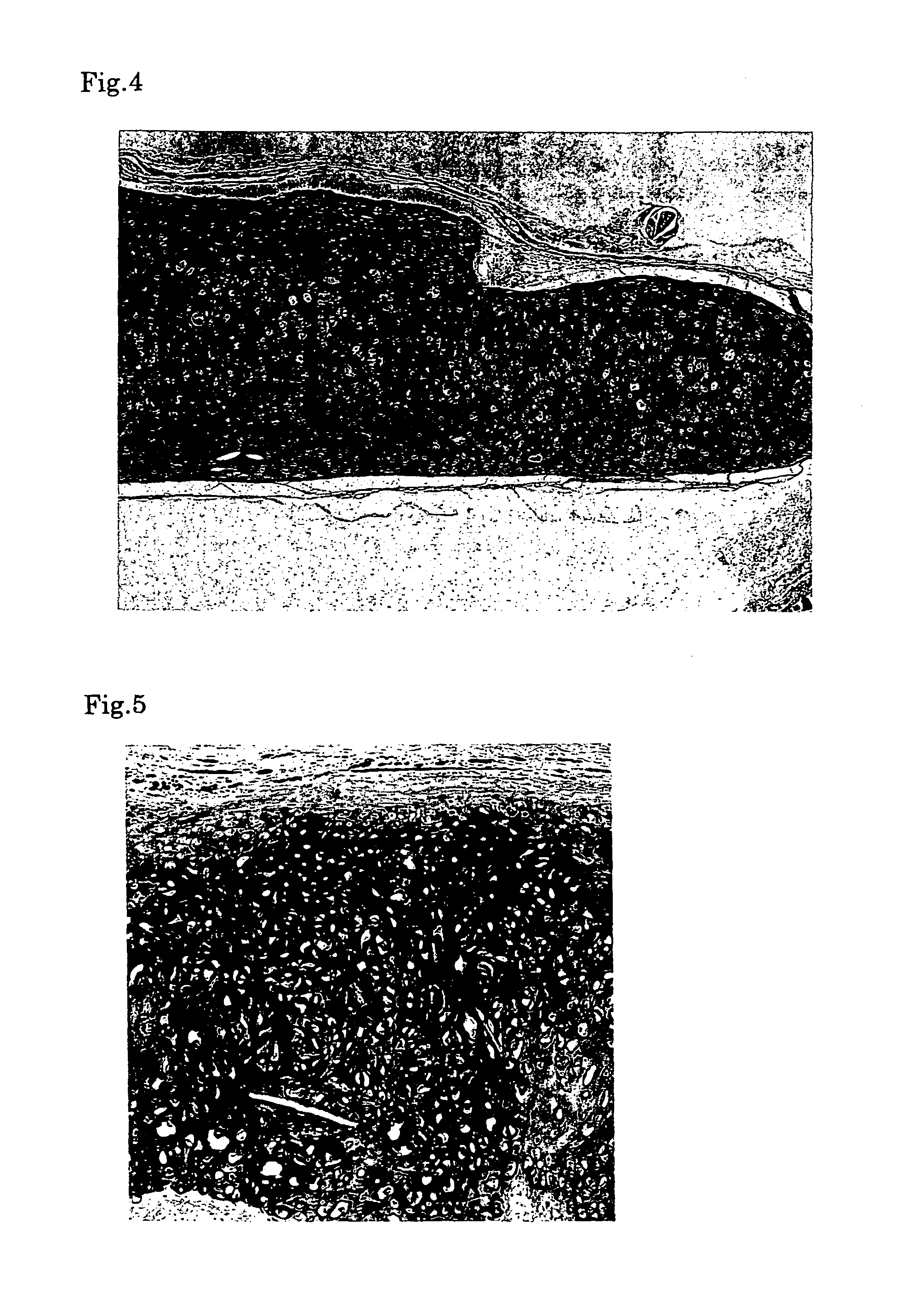 Process for producing cartilage cells for transplantation