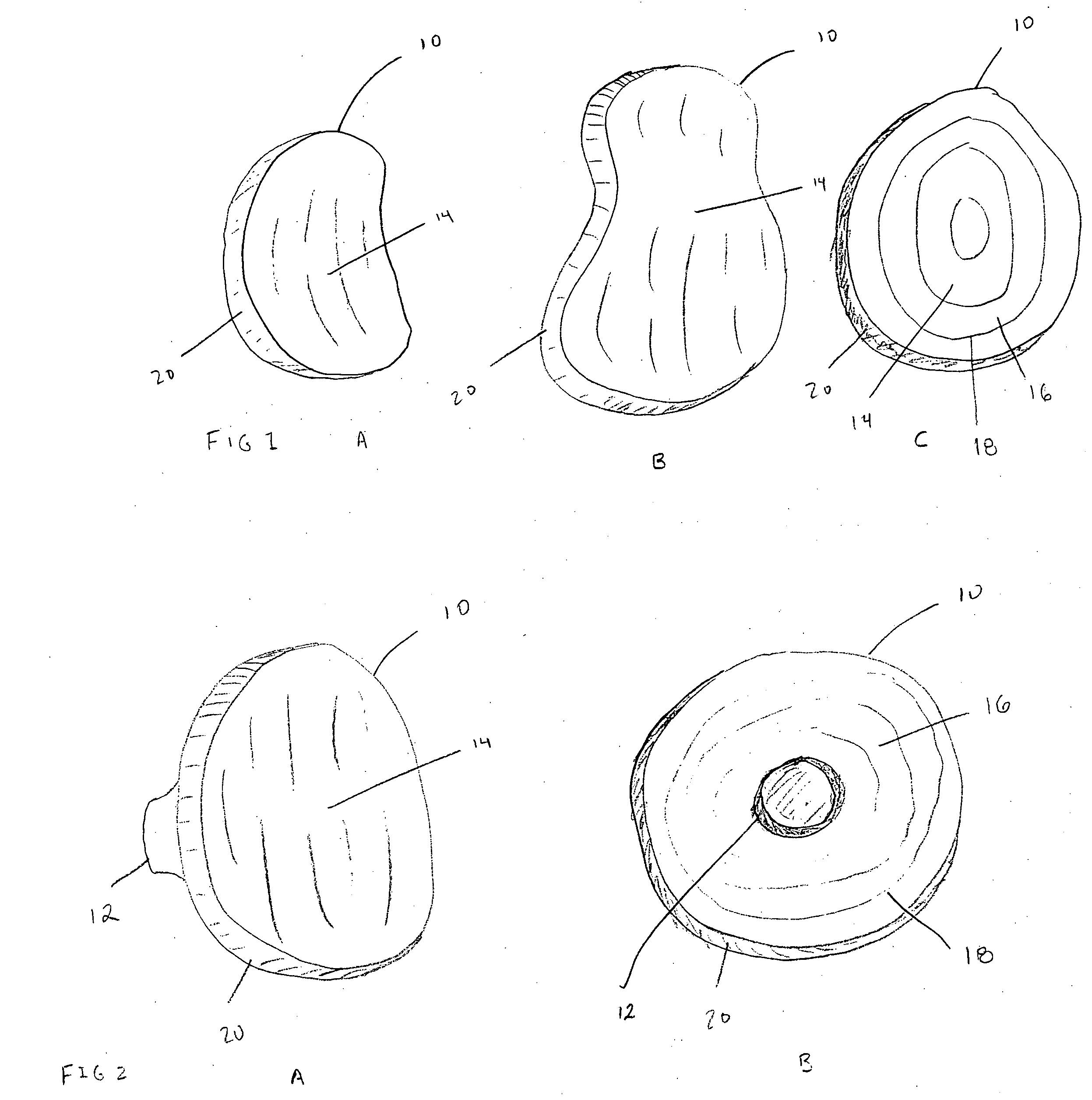Shoulder implant for glenoid replacement and methods of use thereof