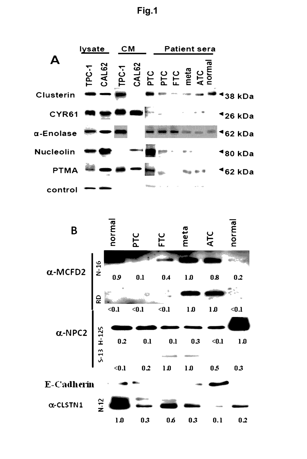 Method and Compositions for the Diagnosis of a Thyroid Condition