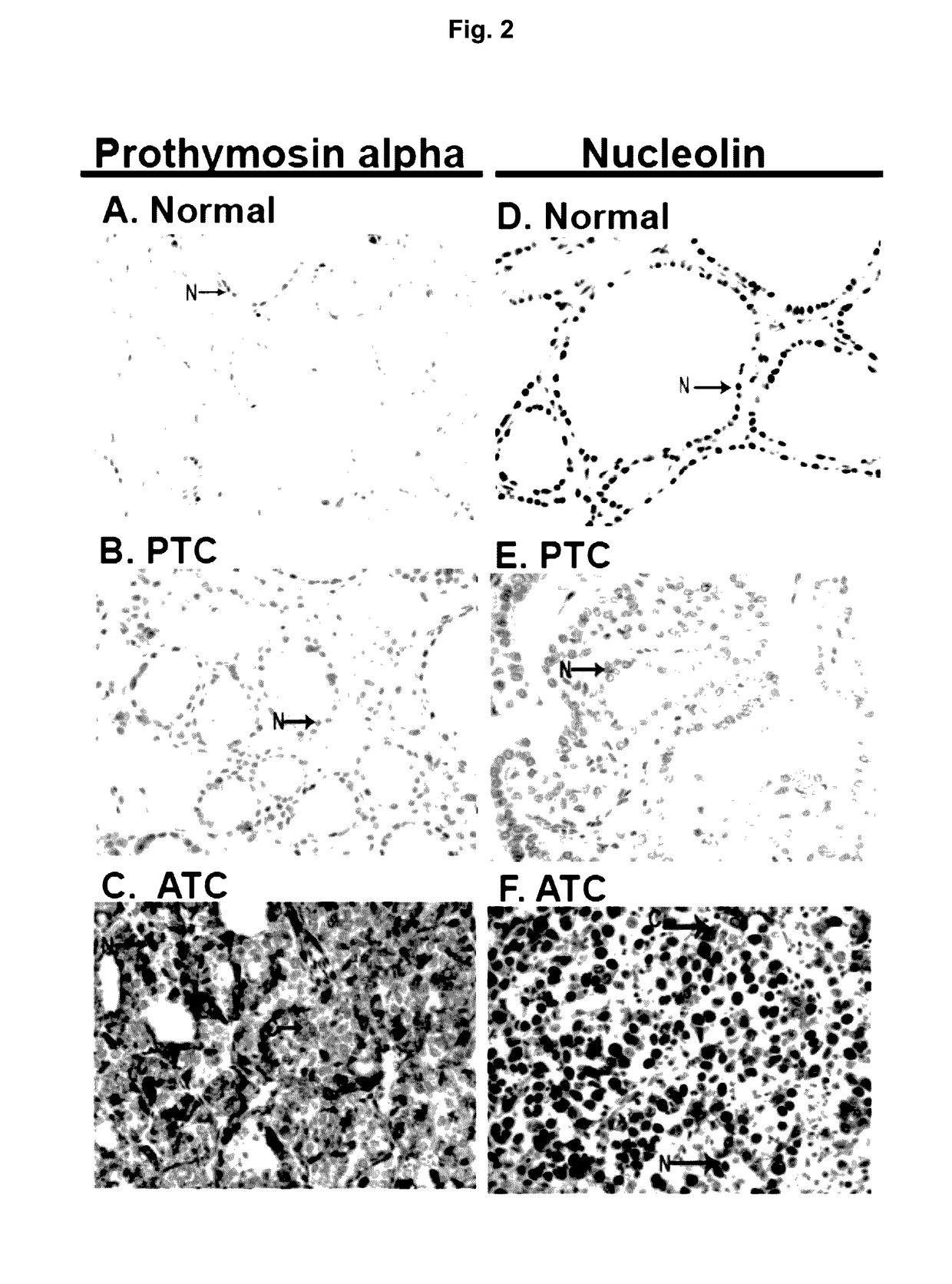 Method and Compositions for the Diagnosis of a Thyroid Condition