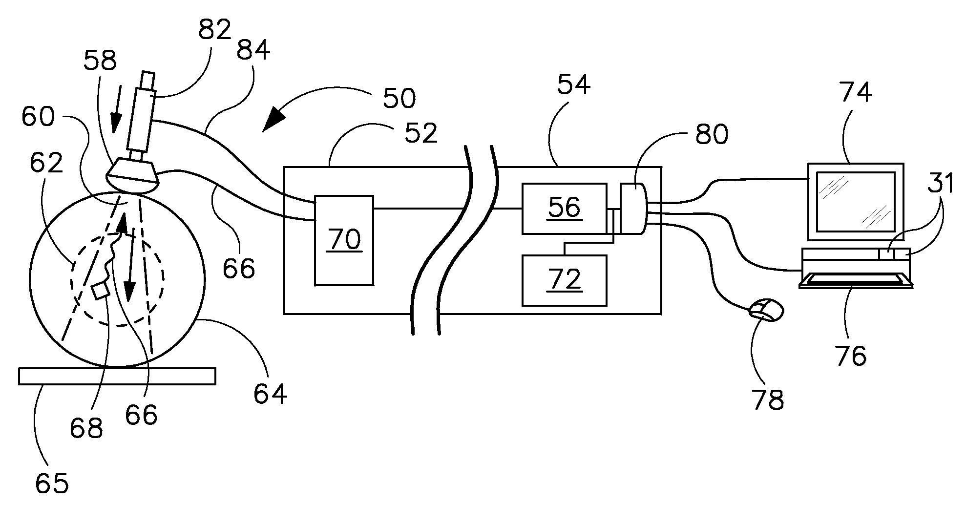 System and method of ultrasound image processing