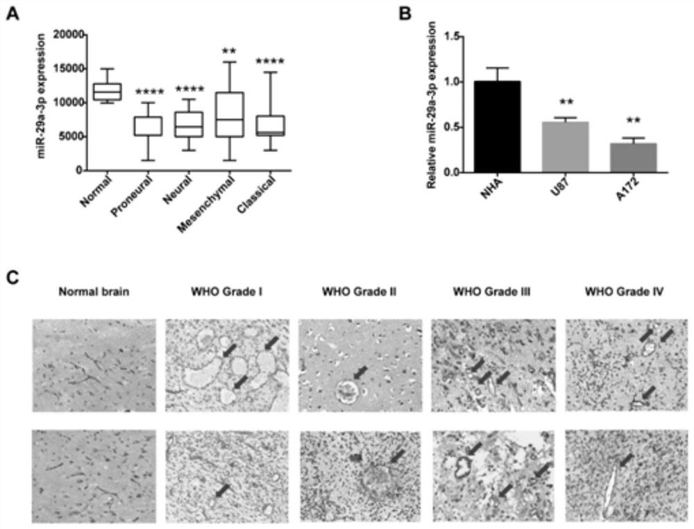 Application of microRNA-29a-3p as a target for the prevention and treatment of vascular mimicry in glioma