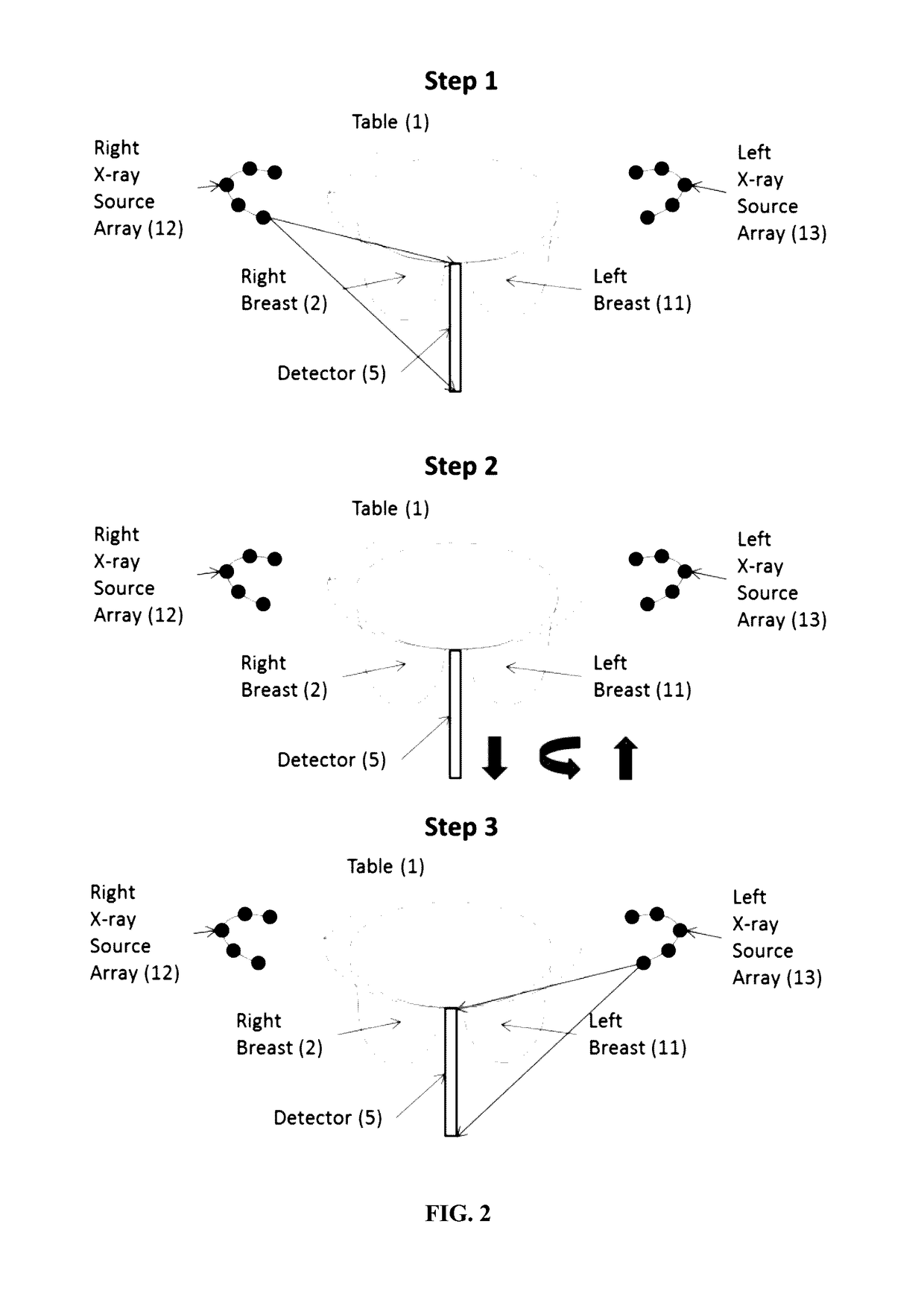 Apparatus and method for x-ray-based breast imaging