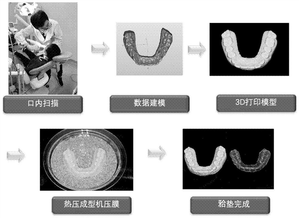 A digital preparation method of an oral protection device for dental trauma fixation