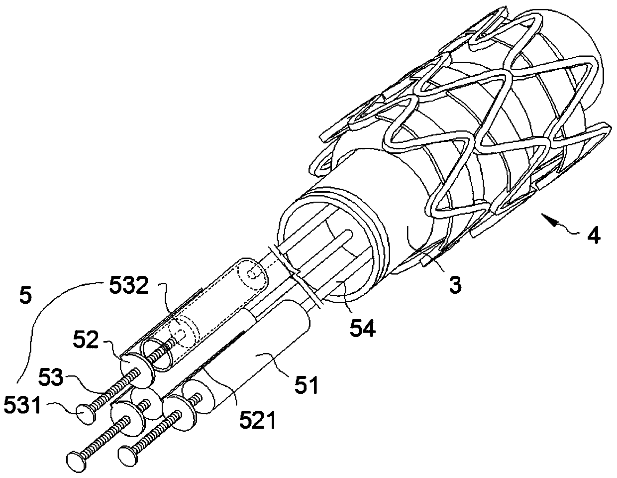 Multilayer saccule bracket