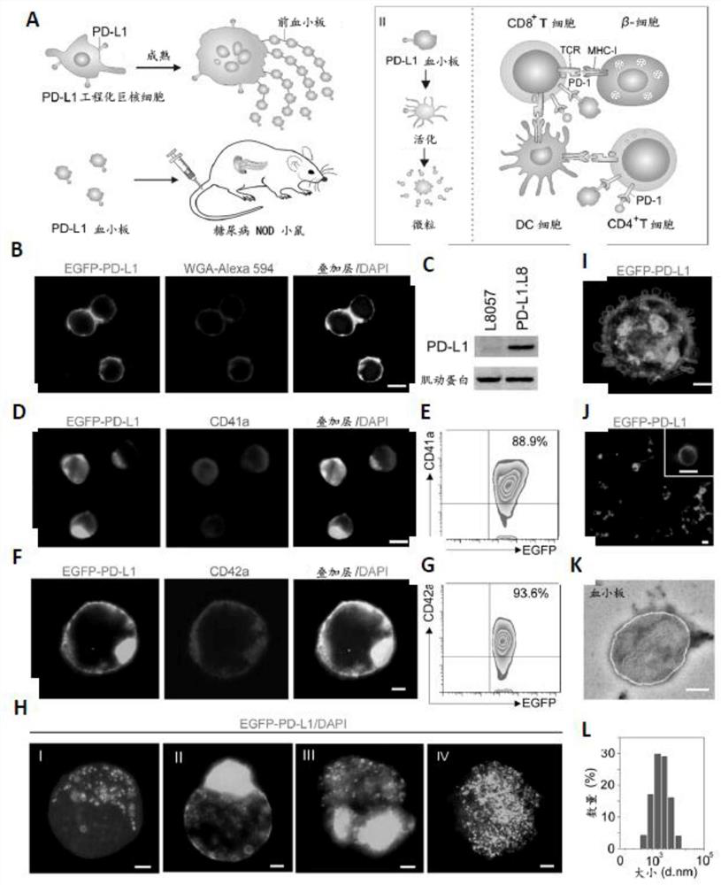 PD-L1 presenting platelets reverse new-onset type 1 diabetes