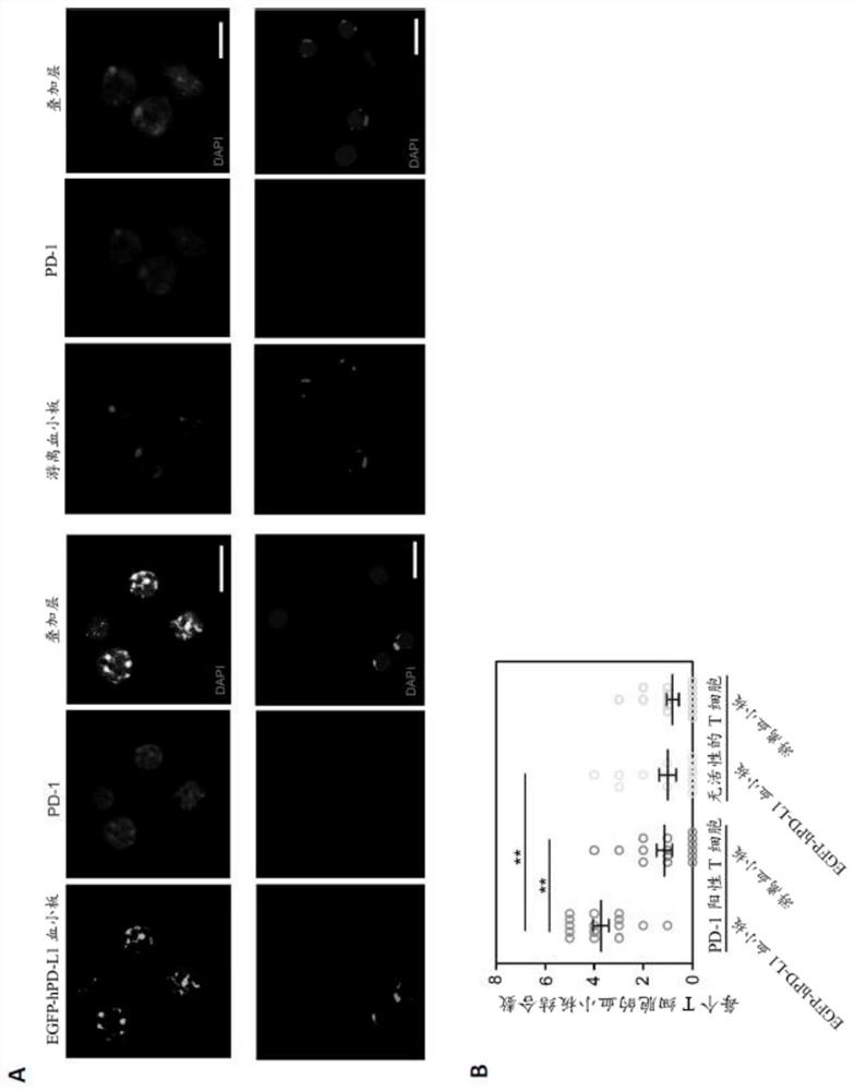 PD-L1 presenting platelets reverse new-onset type 1 diabetes