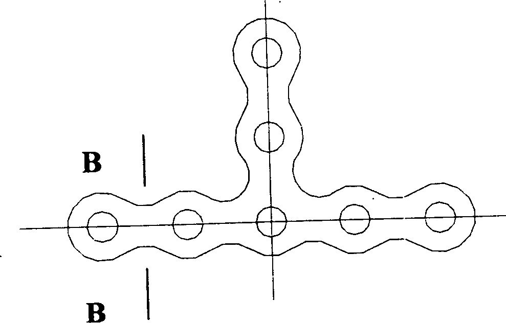 Surface active strong internal fixed titanium bone connection plate and its making method