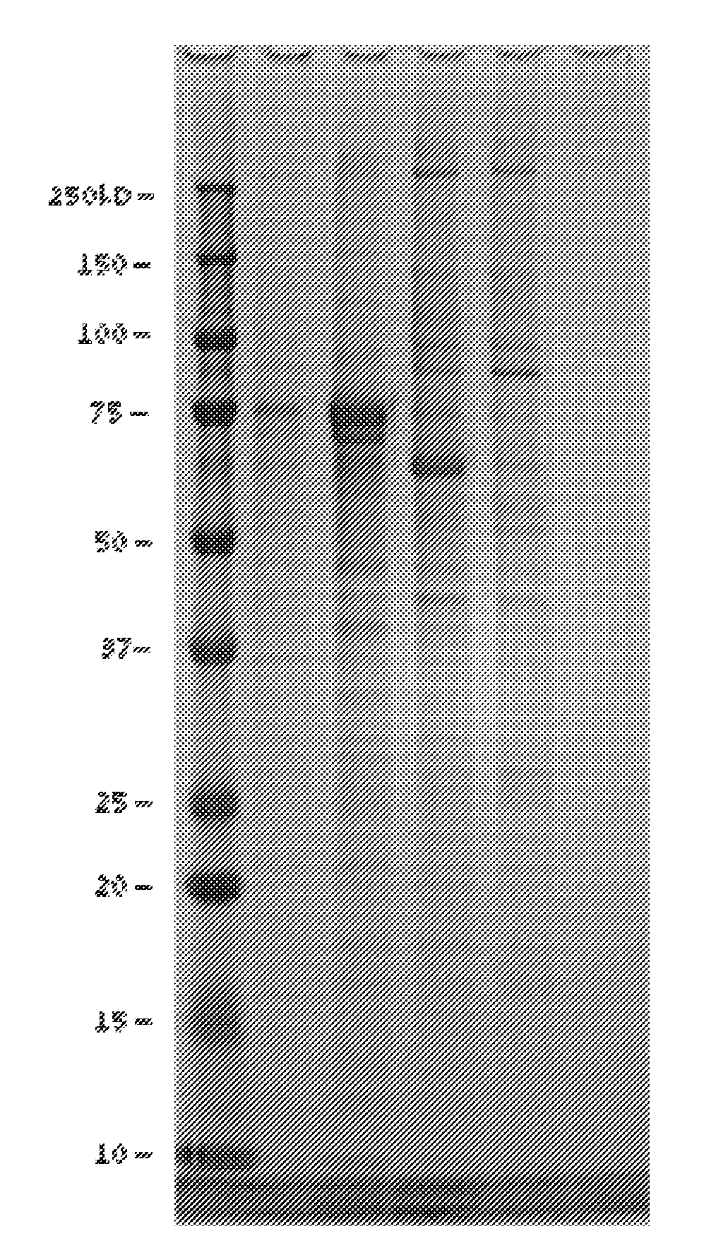 Methods of modulating the negative chemotaxis of immune cells