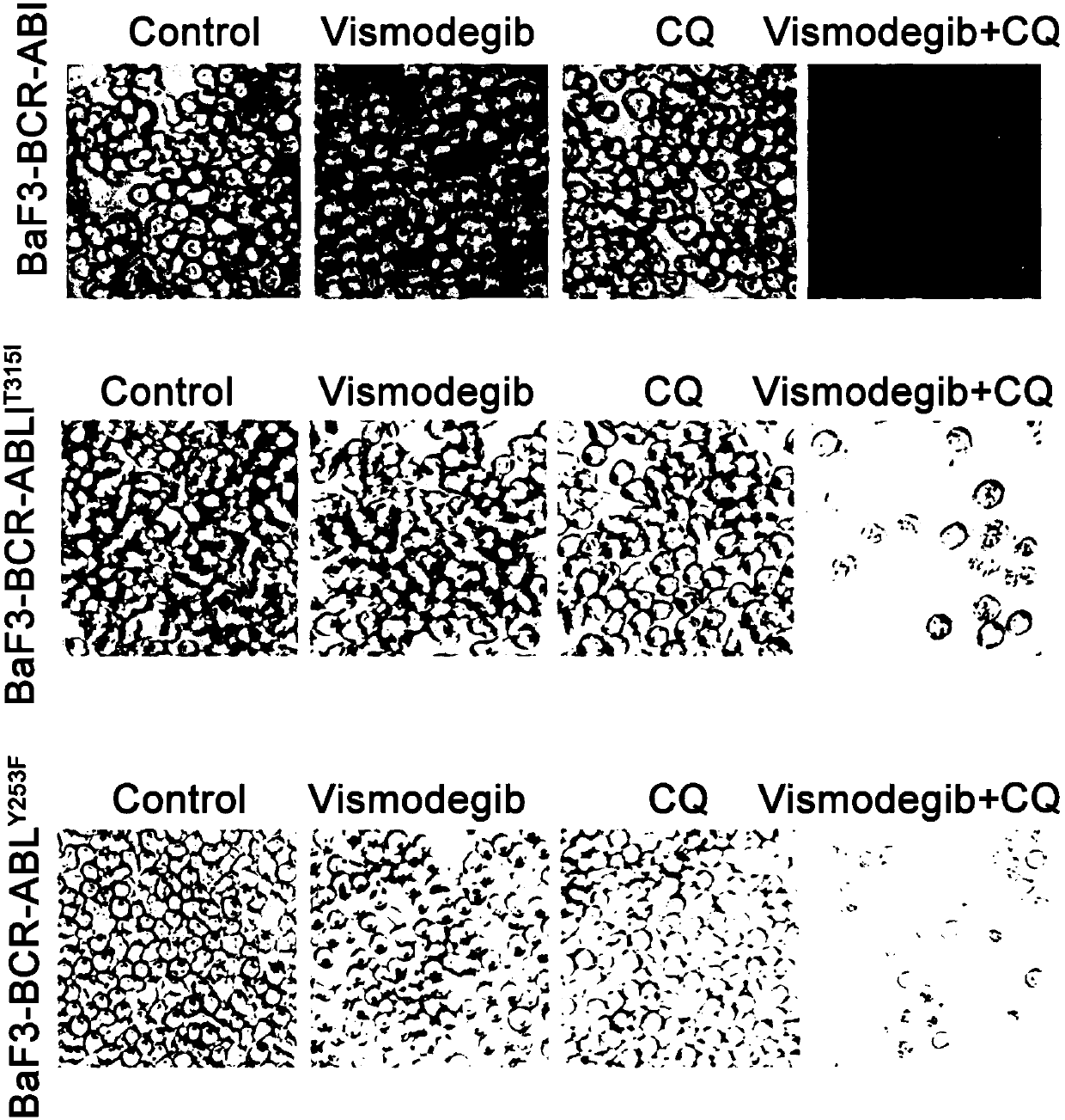 An anti-tumor pharmaceutical composition targeting hedgehog pathway and autophagy