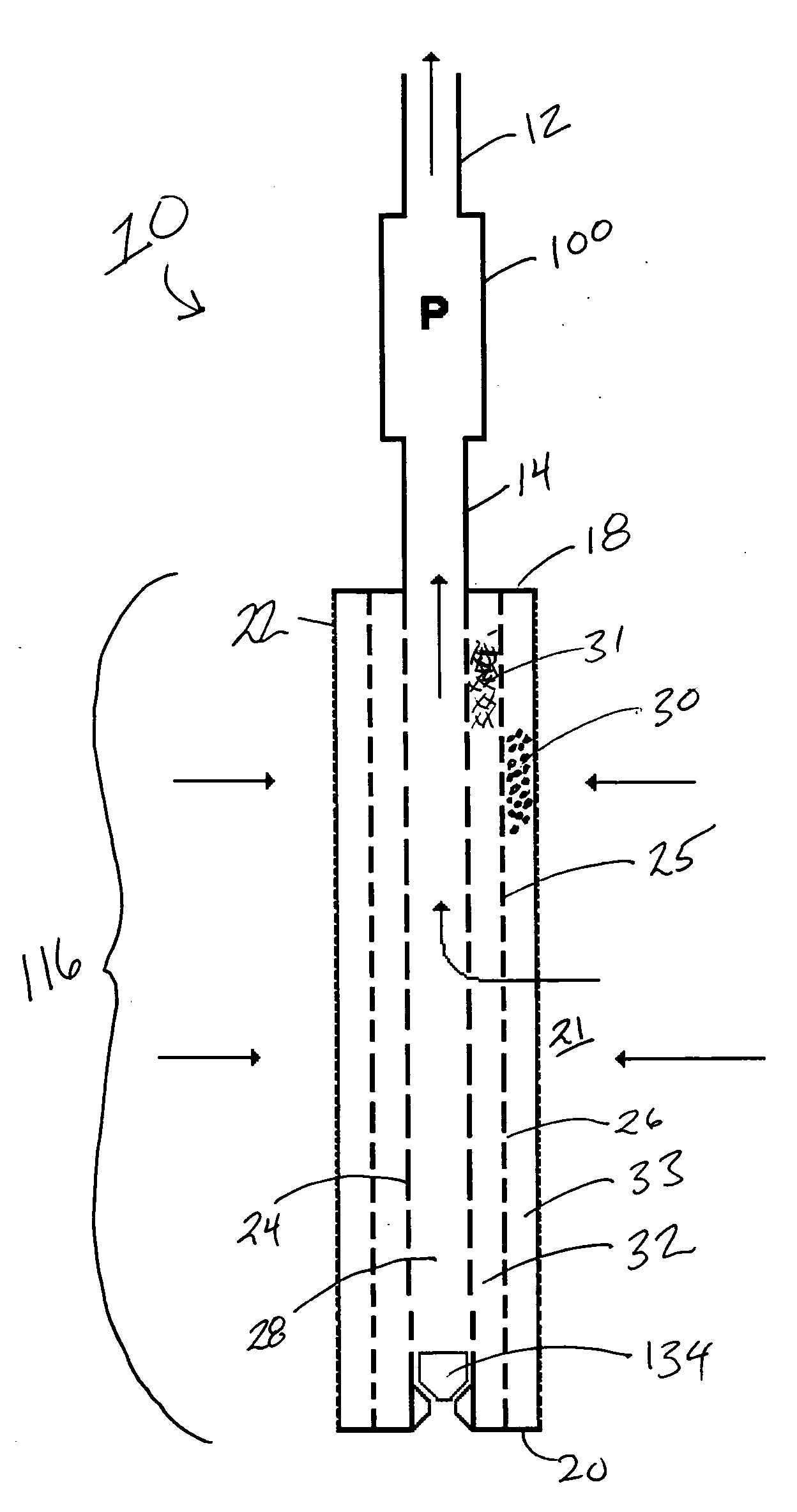Method and apparatus for downhole artificial lift system protection