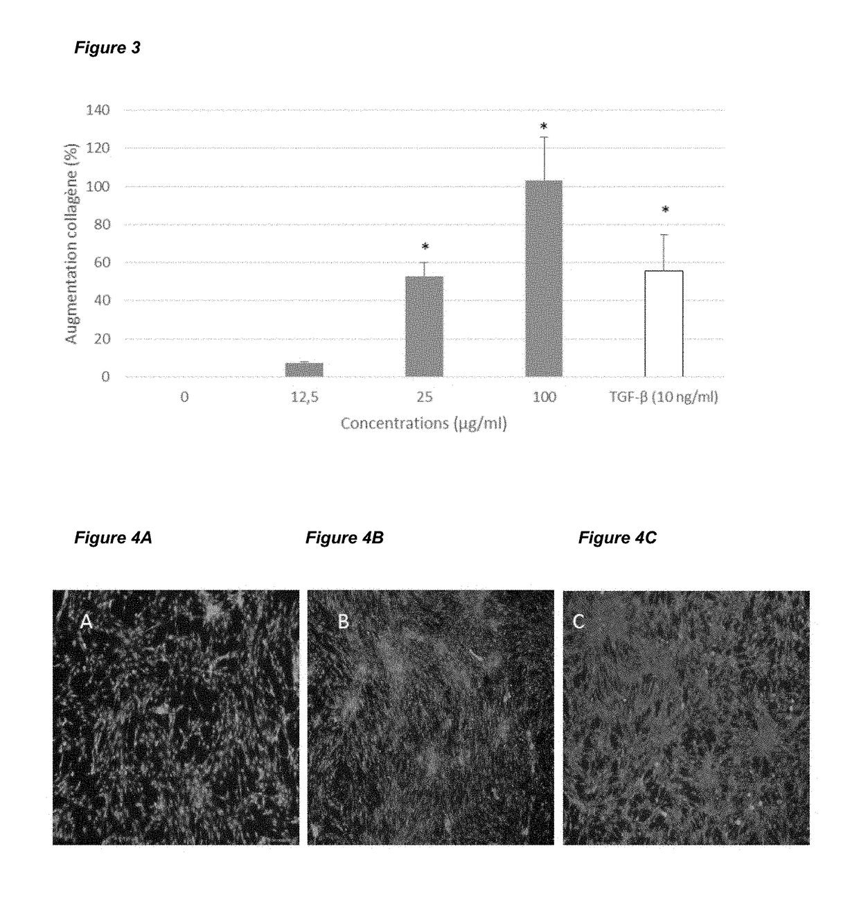Tree bark extract as Anti-aging composition and uses thereof