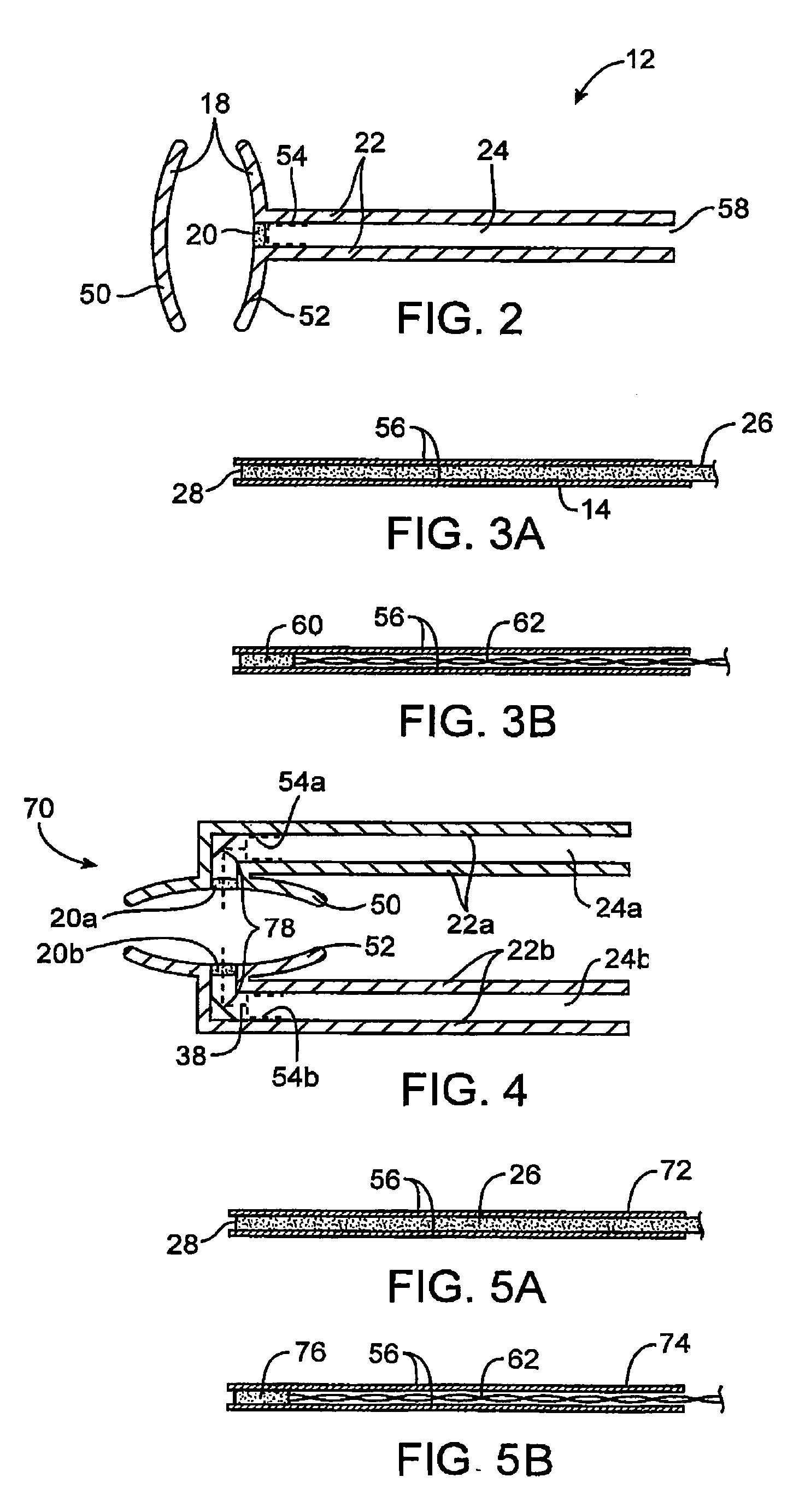 Oral health measurement clamping probe, system, and method