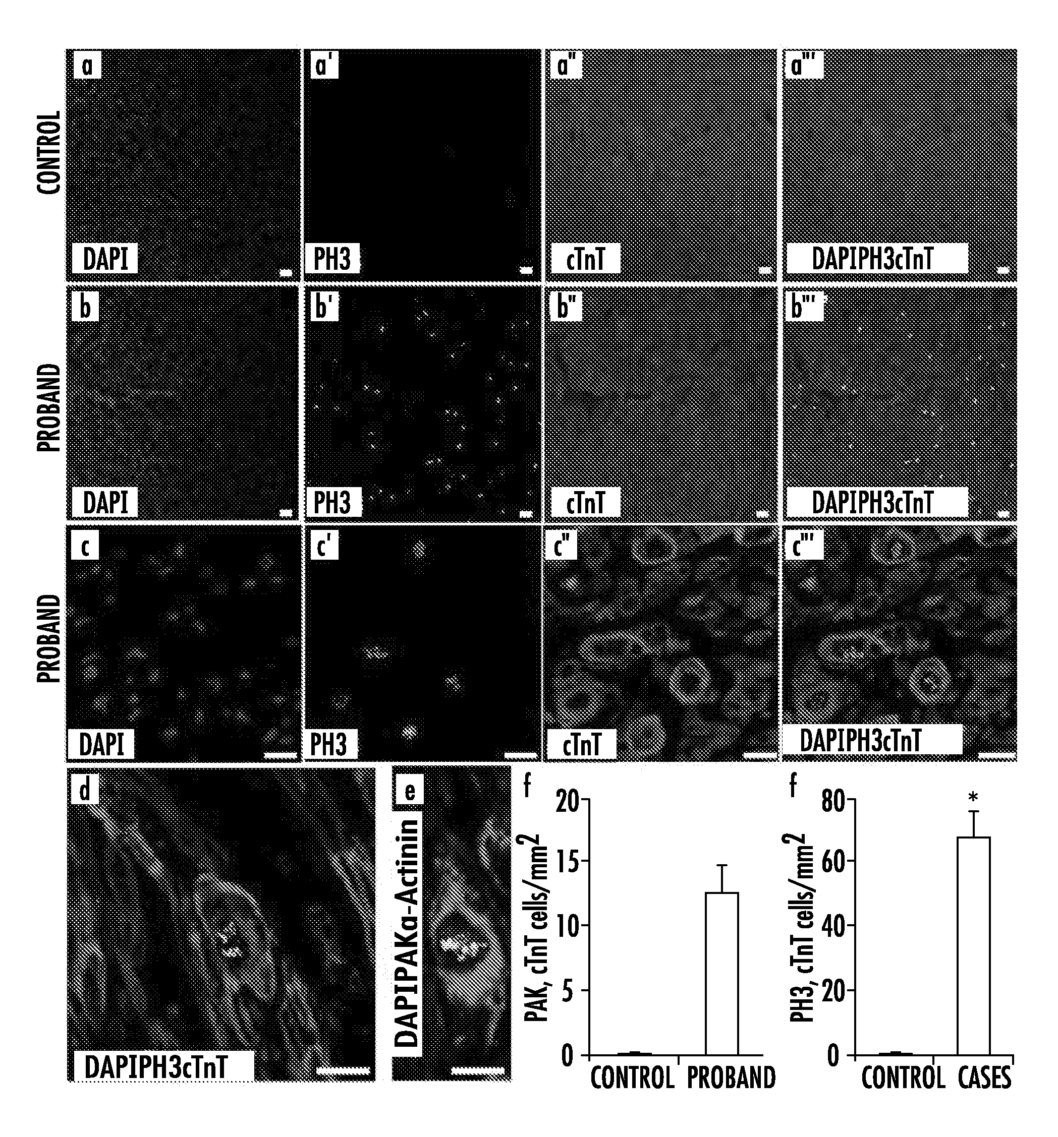 Reduction of ALMS1 gene expression or inhibition of altröm protein to induce cardiomyocyte proliferation