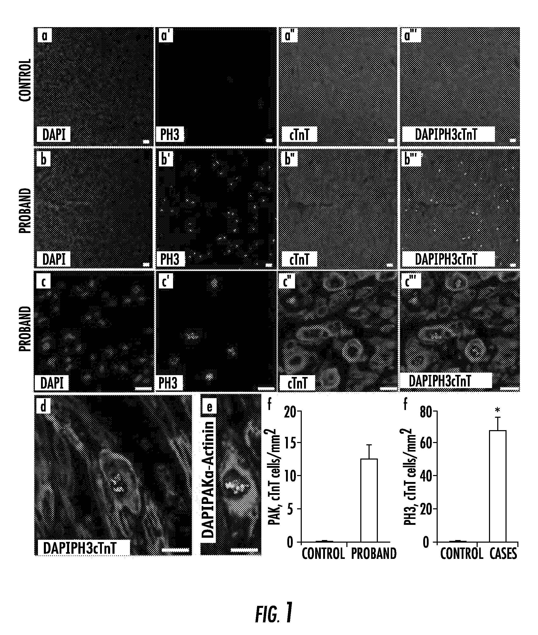 Reduction of ALMS1 gene expression or inhibition of altröm protein to induce cardiomyocyte proliferation