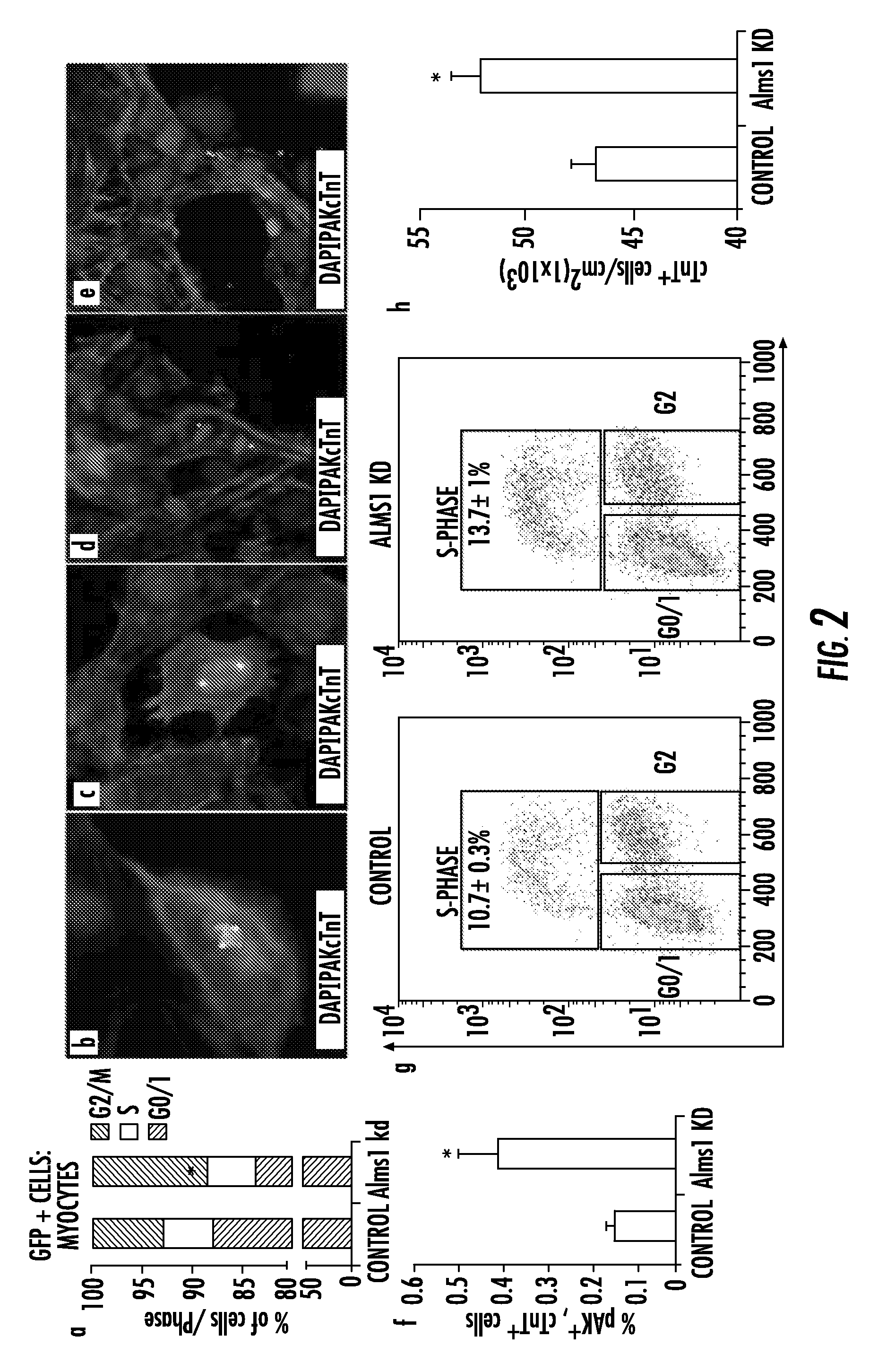 Reduction of ALMS1 gene expression or inhibition of altröm protein to induce cardiomyocyte proliferation