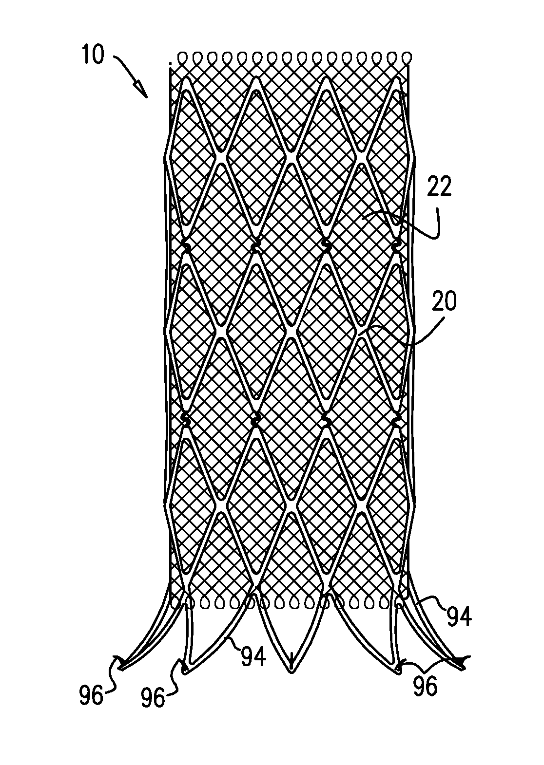 Double-layer stent