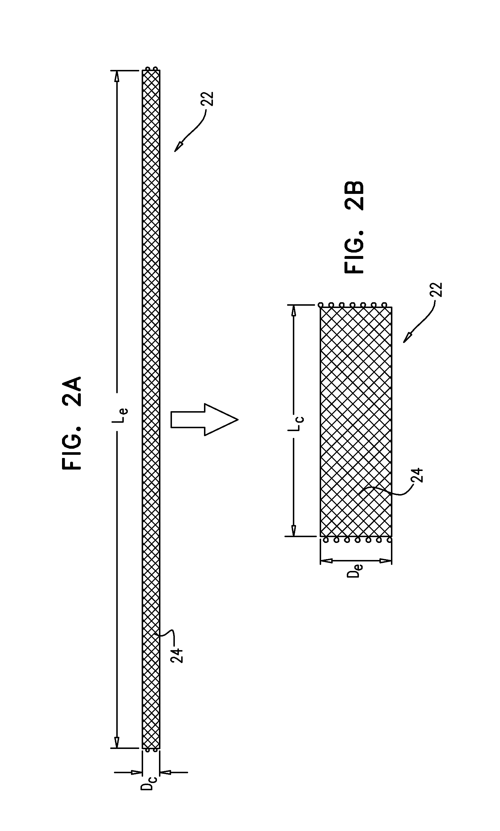 Double-layer stent