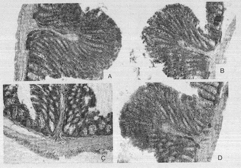 Medicine for preventing and curing middle and old aged constipation