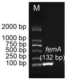 Kit extraction method suitable for Staphylococcus aureus genomes