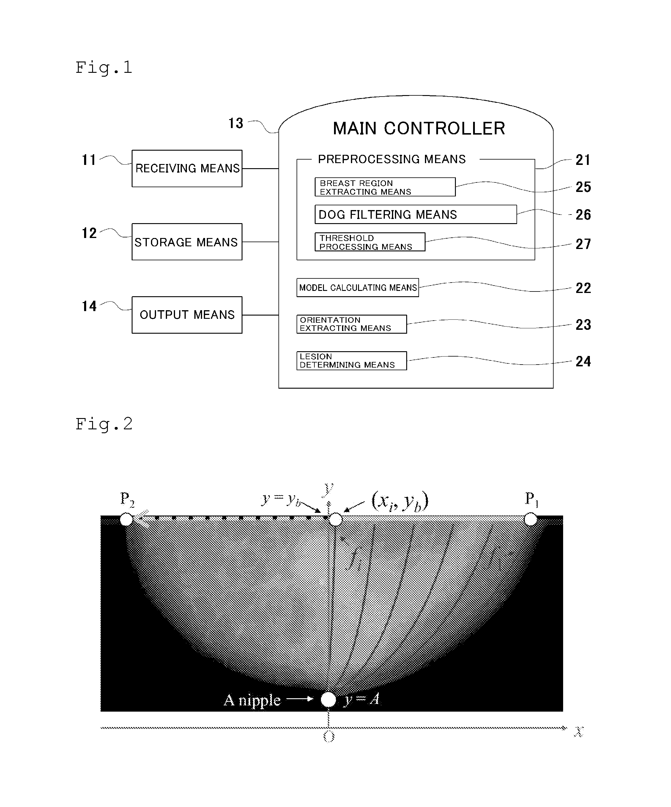 Breast cancer detection system, breast cancer detection method, breast cancer detection program, and computer-readable recording medium having breast cancer detection program recorded thereon