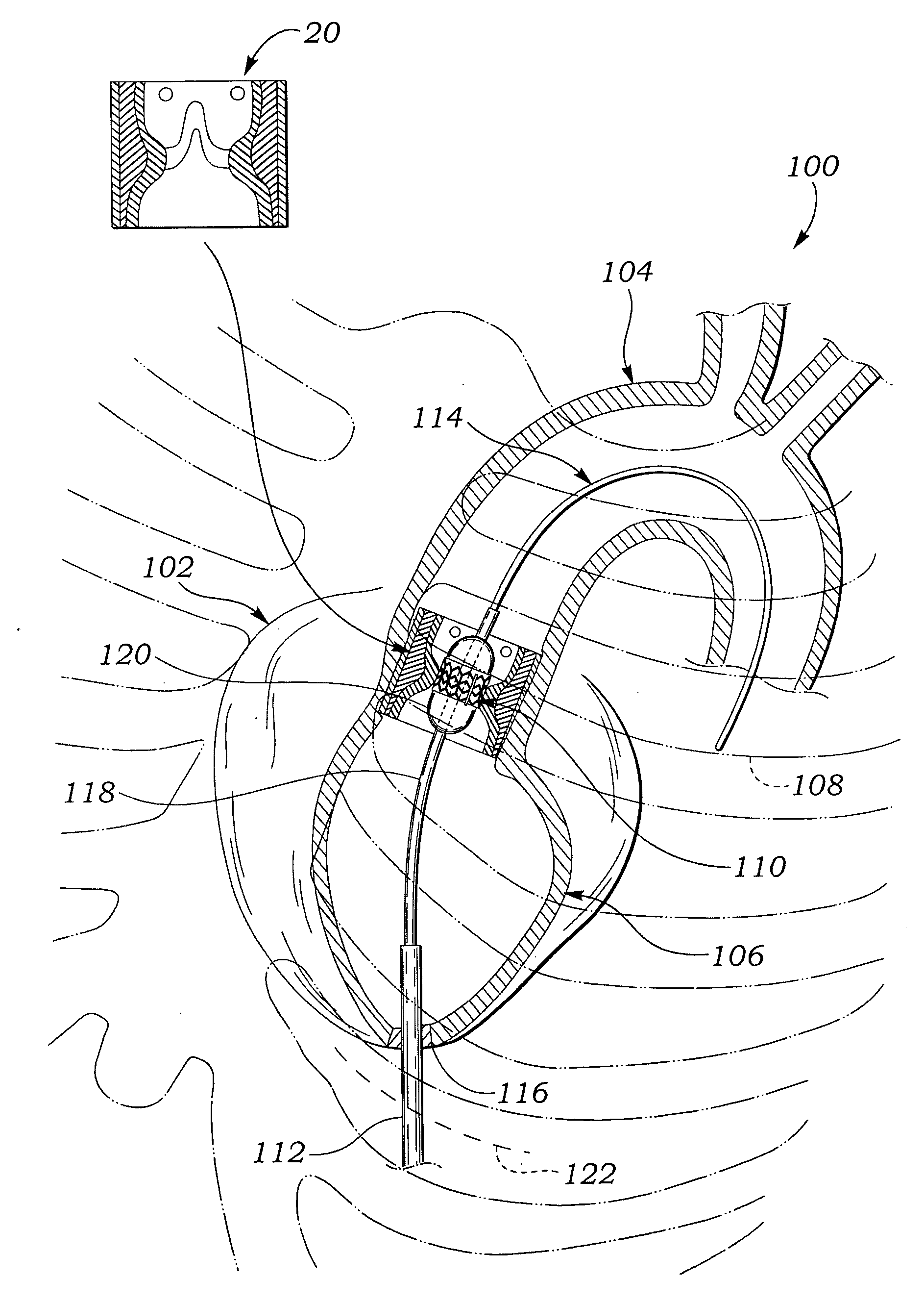 Simulated heart valve root for training and testing