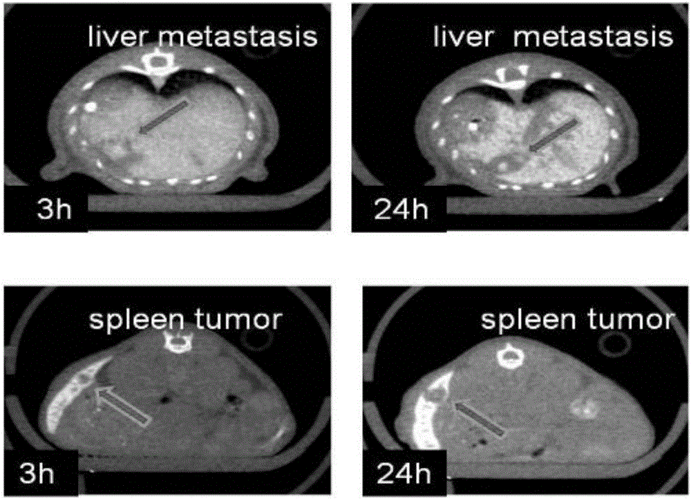 Colorectal cancer liver metastasis animal model construction method for multi-modal imaging research