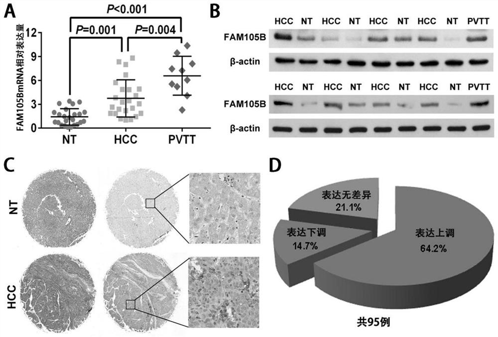 Application of delinearized ubiquitin enzyme family with sequence similarity 105, member B (FAM105B) to liver cancer diagnosis, treatment and prognosis judgment