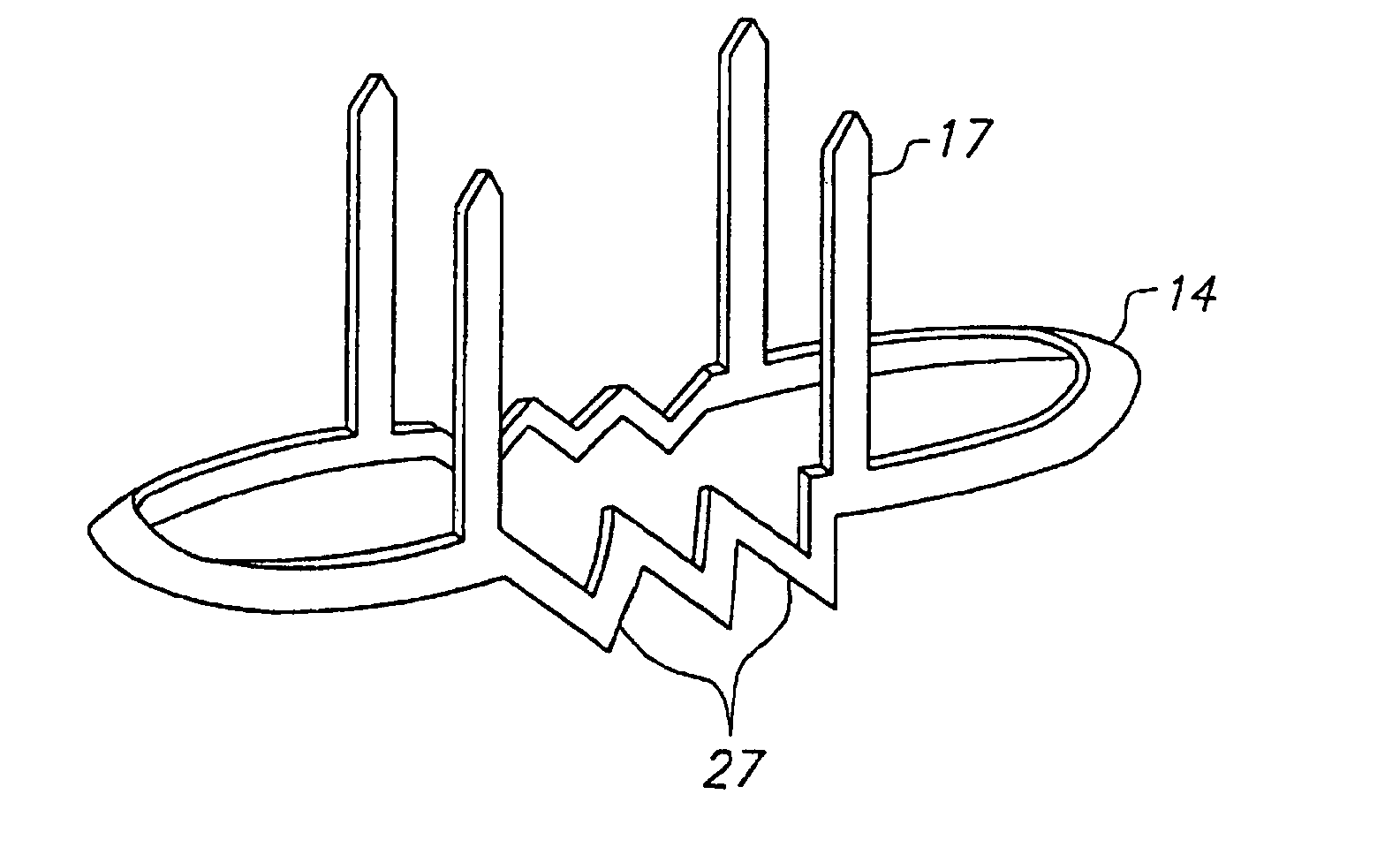 Method and system for attaching a graft to a blood vessel