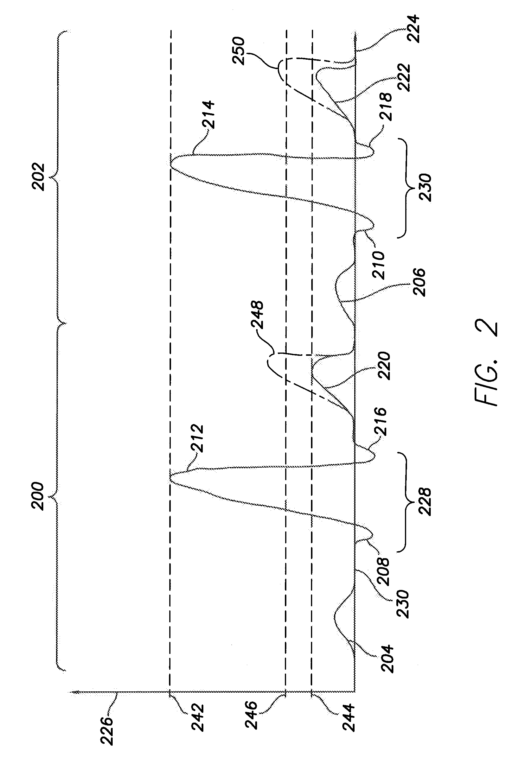 Methods and Systems for Discriminating Between Ventricular Waveforms When Ventricular Rate Exceeds Atrial Rate
