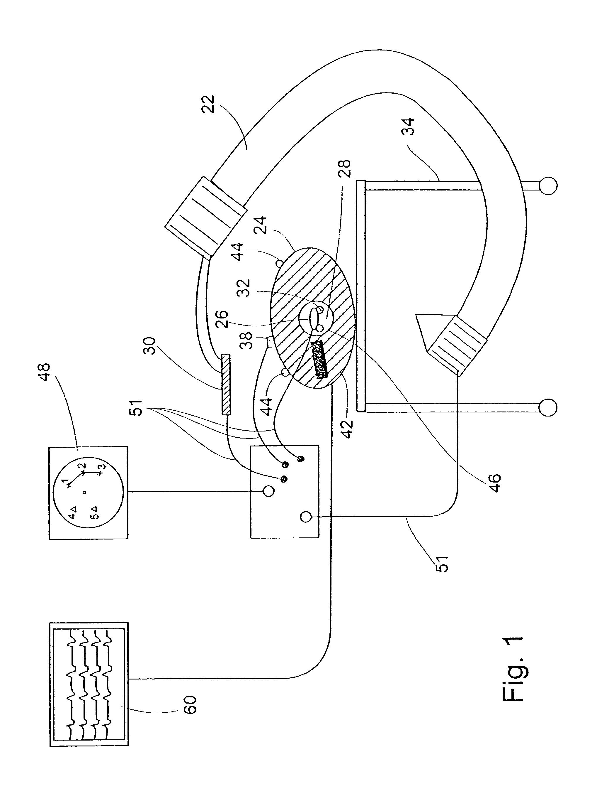System and method of recording and displaying in context of an image a location of at least one point-of-interest in a body during an intra-body medical procedure