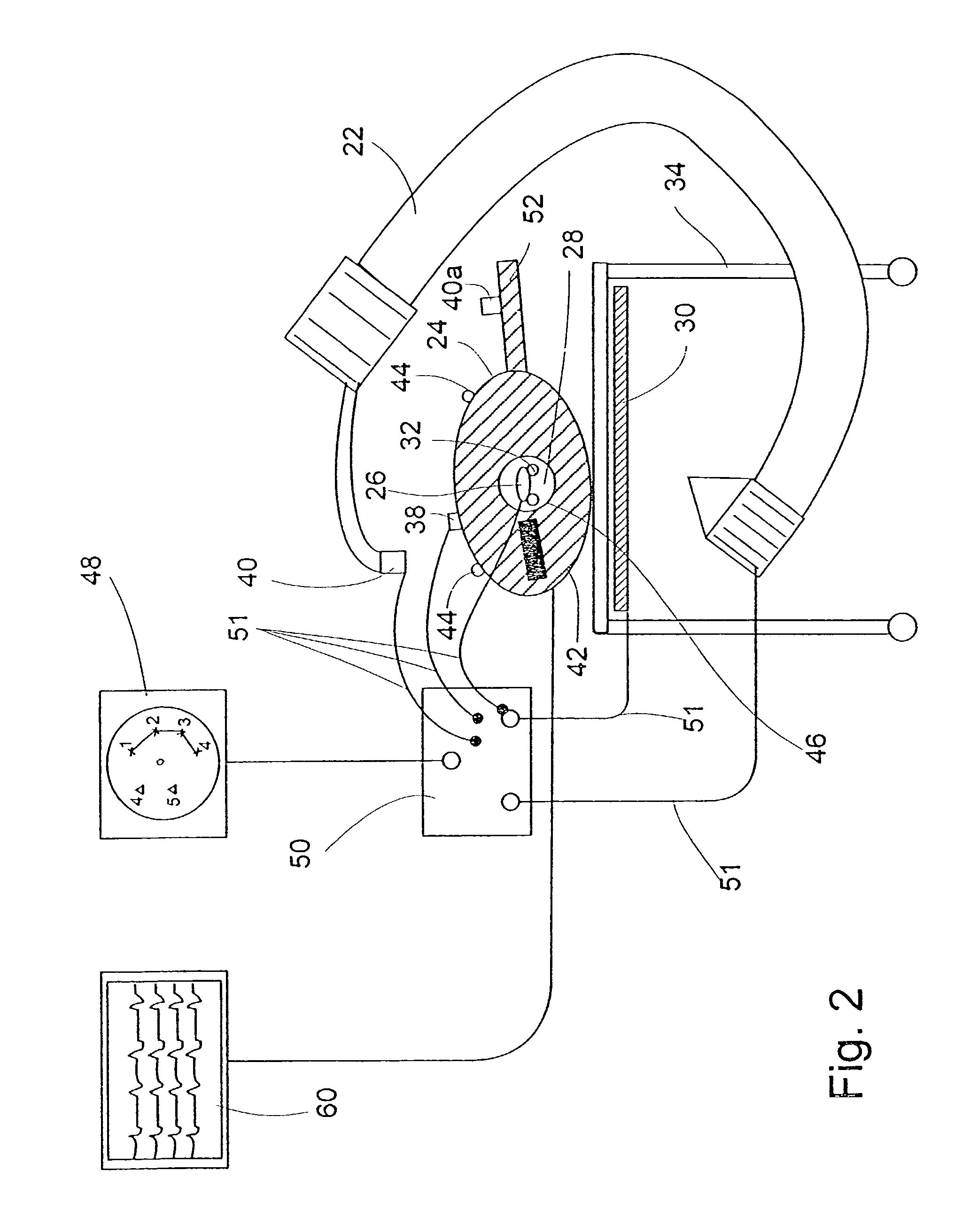 System and method of recording and displaying in context of an image a location of at least one point-of-interest in a body during an intra-body medical procedure