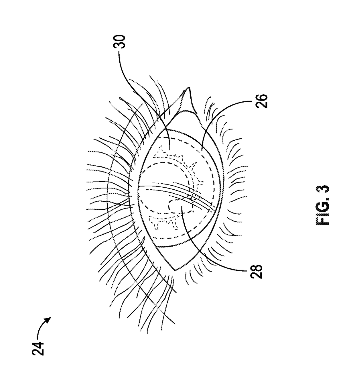 Drug delivery system and method of treating ocular diseases in animals