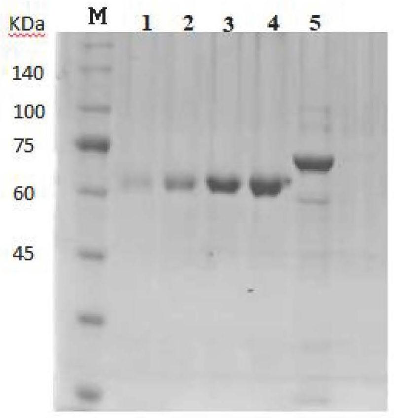 Metal phosphatase as well as carrier, storage solution and preparation method thereof