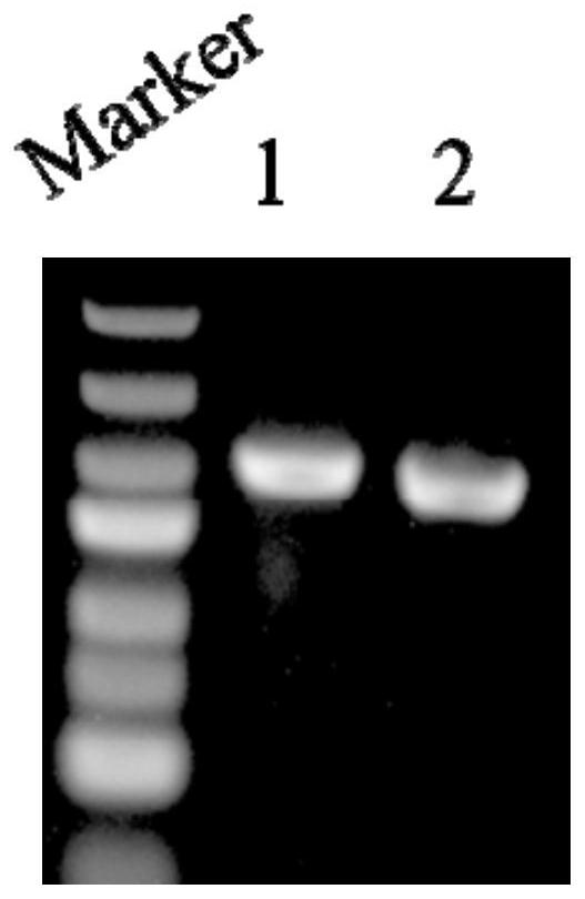 Genetic engineering strain for producing sterol side chain incomplete degradation product as well as construction method and application of genetic engineering strain