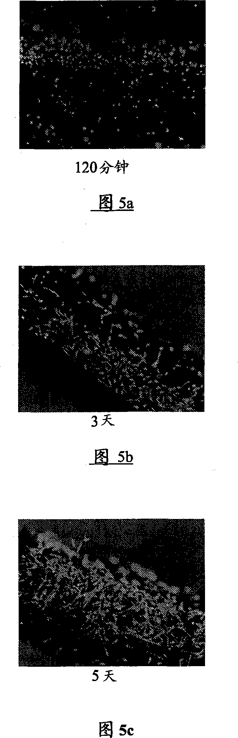 Medical devices comprising a reticulated composite material
