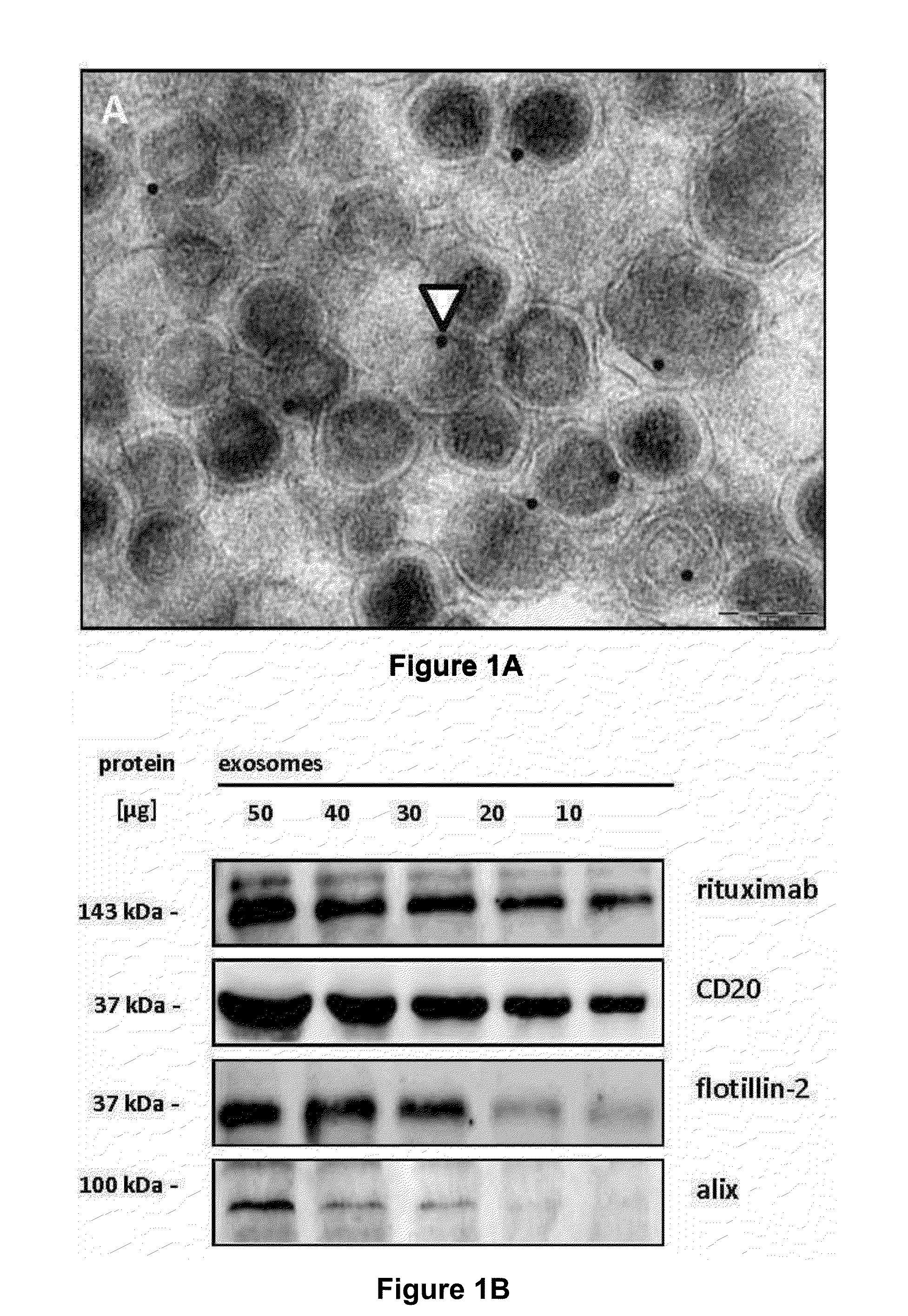 Exosome inhibiting agents and uses thereof