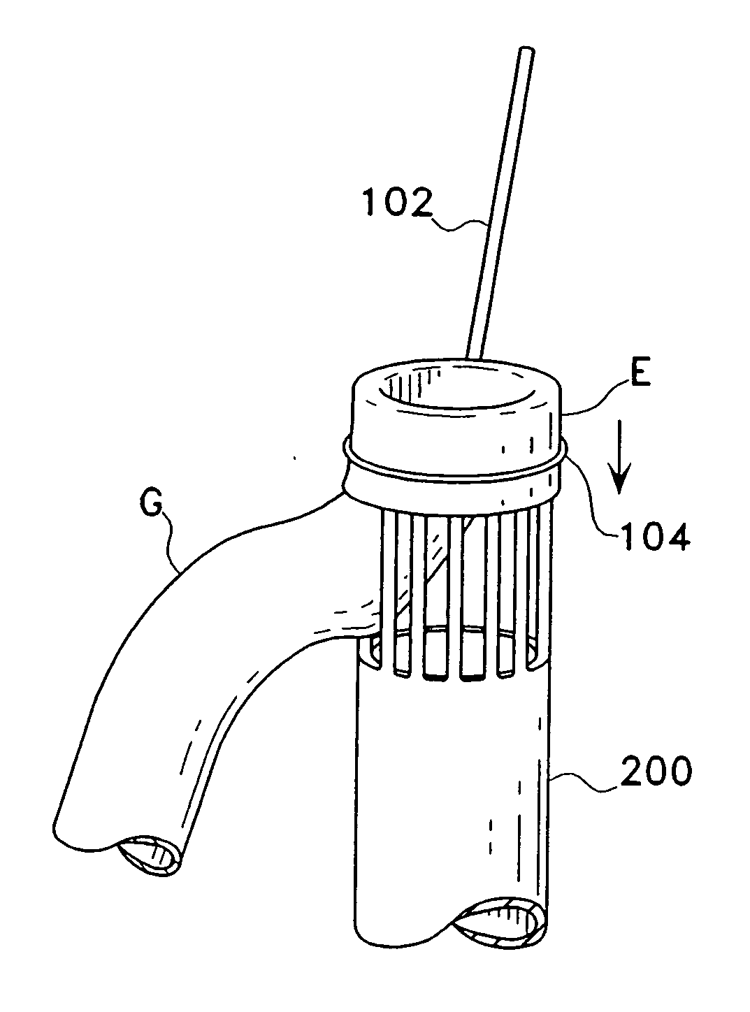 Eversion apparatus and methods